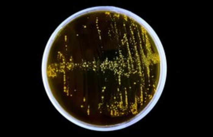 The adopted bacterium - Lactobacillus casei | A Listly List