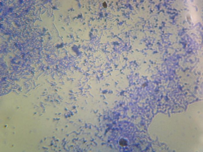 The adopted bacterium - Lactobacillus casei | A Listly List