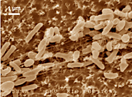 Figure 1: An image of Ideonella sakaiensis bacteria shown under scanning electron microscopy