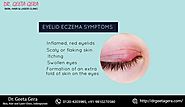 It's possible to treat eyelid eczema,... - Dr. Geeta Gera Skin, Hair & Laser Clinic | Facebook