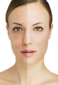 What are the Different Kinds of Facial Implants?