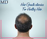 Effective Hair Growth Products for Men