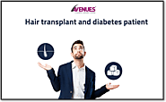 Is Hair Transplant Possible For A Diabetic Patient – Avenues Cosmetic
