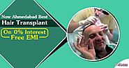 Advance Feature Of hair Transplant Surgery With Guaranteed Results