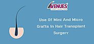Use Of Mini And Micro Grafts In Hair Transplant Surgery – Hair Transplant In Gujarat