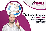 Follicular Grouping The Innovative Hair Transplant Technique – Hair Transplant In Gujarat