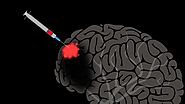 Delivering Drugs To The Brain Is Now A Reality - Biomedical Engineering | ACSCE