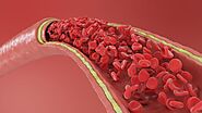 How Do Arteries Supply Blood to the Body? | USA Vascular Centers