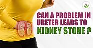 Ureter Treatment Delhi For Kidney Stone