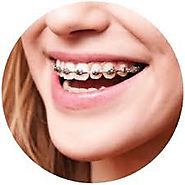 A name you can rely upon — Orthodontics Irving Texas