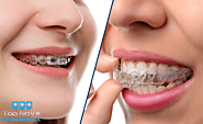 Braces or Invisalign Which is The Best For You