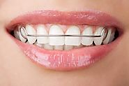 When to Consult Orthodontist for Restoring Your Smile
