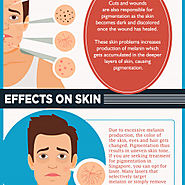 Everything you need to know about Pigmentation