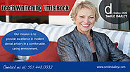 Teeth Whitening Little Rock