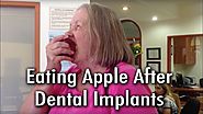 Dental Implant Patient Eating Apple, Fixed teeth in Sherman Oaks, Los Angeles