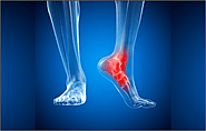 Ankle Fractures: Causes & Symptoms & Doctor Examination