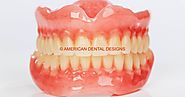 American Dental Lab: Looking for Dental Implants in Philadelphia, PA?