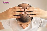 Start With These Simple Methods To Stops Baldness