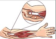 Elbow Tendinitis and Tennis Elbow Treatment