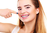 Facts about orthodontist you didn’t know