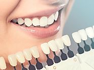 Few things to know before taking up the Invisalign procedure