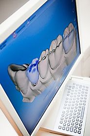 Oral 3D scanning with Mountain View Orthodontics in Roanoke