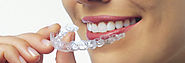 Teeth Straightening treatment are effective than ever with adult dental braces