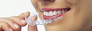 Why Invisalign Is Gradually Becoming One of the Most Effective Teeth Straightening Treatment