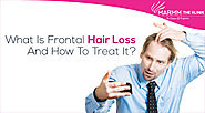 What Is Frontal Hair Loss And How To Treat It? – Hair Treatment