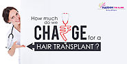 How Much Do We Charge For A Hair Transplant? – Hair Treatment