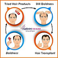 Hair Transplant Procedure: A Viable Operative Solution To A Hair Loss Problem – Hair Treatment