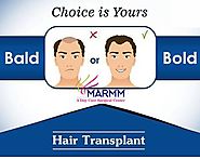 Find The Right Hair Transplant Clinic By Researching These Criteria – Hair Treatment