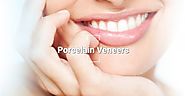 Porcelain veneers Melbourne experts are clearing all doubts regarding treatment