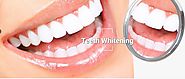 What to ask your cosmetic dentistry Melbourne expert for Teeth Whitening?