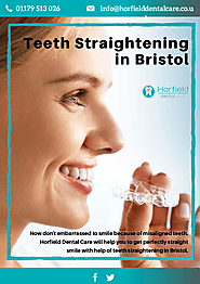 Teeth Straightening in Bristol