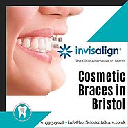 Cosmetic Braces in Bristol