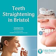 Teeth Straightening in Bristol