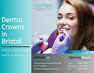 Dental crowns in Bristol