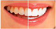 A Complete Tutorial on Whitening Yellow Teeth in Photoshop | Photoshop Backgrounds