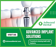 Enhance Smiles with Dental Implants