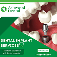 Revolutionizing Smiles with Dental Implants