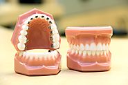 Website at https://topnovaorthodontics.com/different-types-of-dentures/