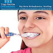 Website at https://topnovaorthodontics.com/diy-whitening-after-braces-maybe-not/
