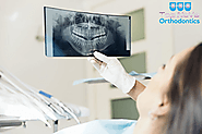 Keeping Good Oral Health Prevents Dental Sensitivity