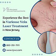 Varicose Veins Laser Treatment in NJ