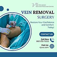 Vein Removal Surgery in NJ