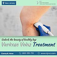 Varicose Veins Treatment in NJ