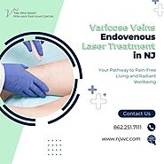 Varicose Veins Endovenous Laser Treatment in NJ