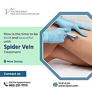 Effective Spider Vein Treatment in NJ