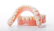 Full or Partial Dentures treatment at Facets Dental Clinic Kochi